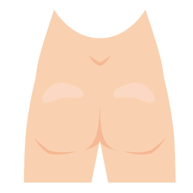 651905 - デリケートな部位だから…「ケツ毛の脱毛」 651905 - デリケートな部位だから…「ケツ毛の脱毛」