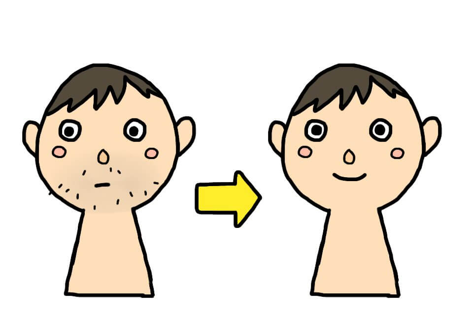 529812 - メンズ脱毛が気になる青ひげにも効果がある理由 529812 - メンズ脱毛が気になる青ひげにも効果がある理由