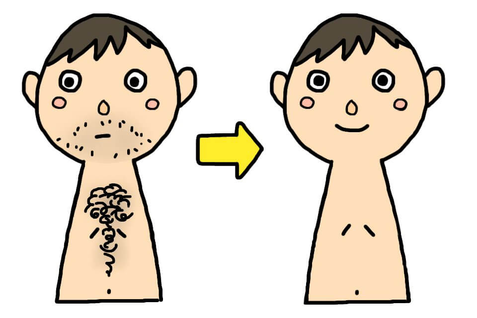 536810 - 女性にモテたい！胸毛や乳毛も脱毛して自信のある裸に