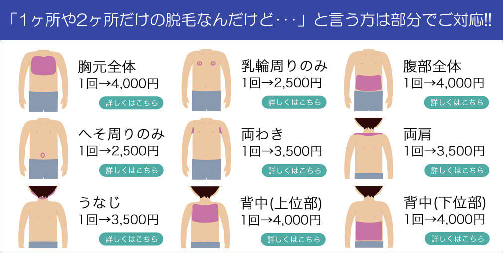 ボディ脱毛プラン1 - メンズ脱毛【NAX】おゆみ野・鎌取店の紹介