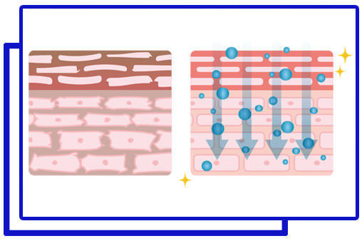 光フェイシャルの流れ2 - ニキビ対策の光エステ