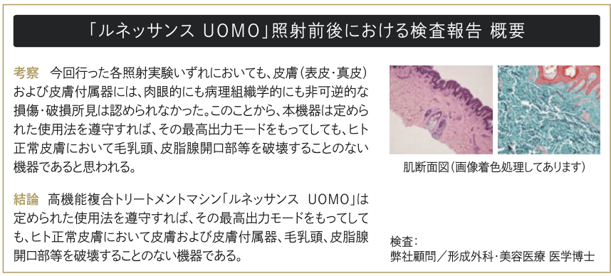 11 - UOMOの紹介