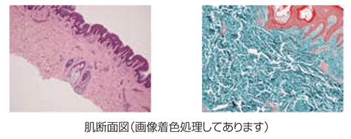 92e96d18aed82cc8ec08fd8 - NAX脱毛の安全性