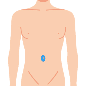 L body heso - ボディ脱毛 4部位セット