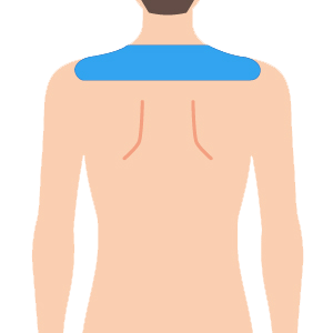 L body kata - ボディ脱毛 4部位セット