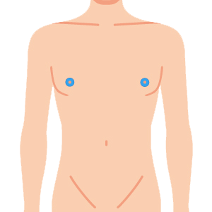 L body nyuurin - ボディ脱毛 4部位セット