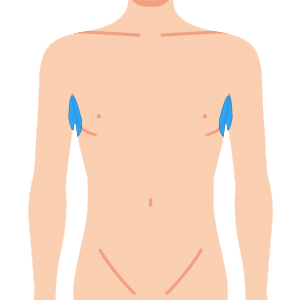 L body waki - ボディ脱毛 4部位セット