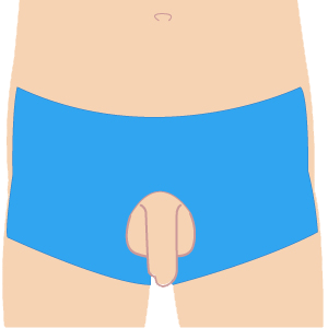 L vio v - VIO脱毛 3部位セット