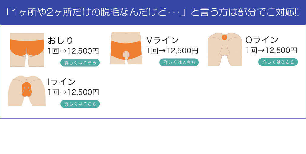 VIO脱毛プラン1 - メンズ脱毛【NAX】おゆみ野・鎌取店の紹介