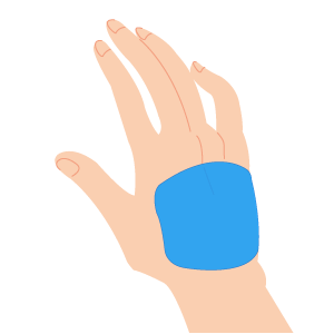 te kou - 両手の甲脱毛