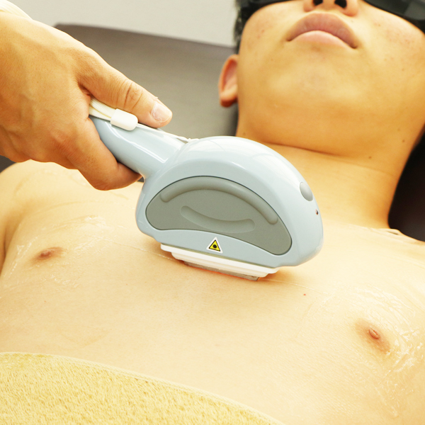 施術 1 - メンズ脱毛NAX定額制LP（コンプライアンス用）