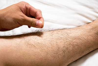 スネ毛 1 - メンズ足脱毛プラン