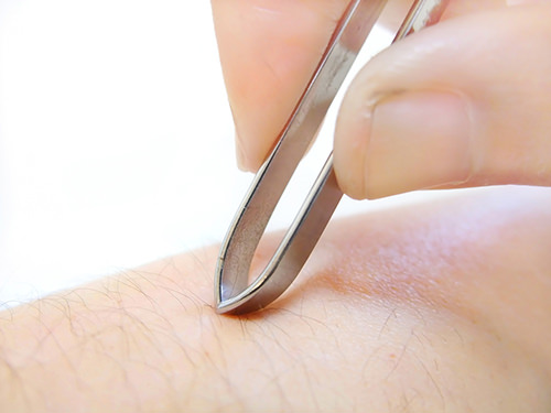 ピンセット - メンズの足脱毛はアリorナシ？カッコよさを演出するなら足脱毛から