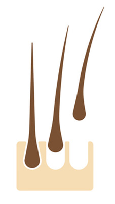 脱毛イラスト - 両足のひざ脱毛