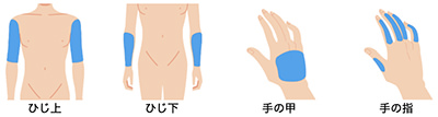 腕脱毛対応部位 - メンズの腕・手脱毛プラン