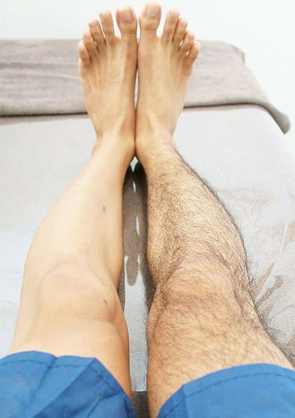 足脱毛効果 - メンズ足脱毛プラン