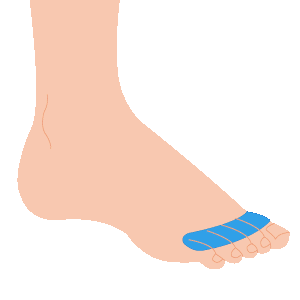 L ashi yubi - メンズ足脱毛プラン