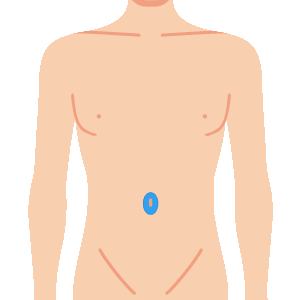 L body heso - メンズ脱毛のメニュー