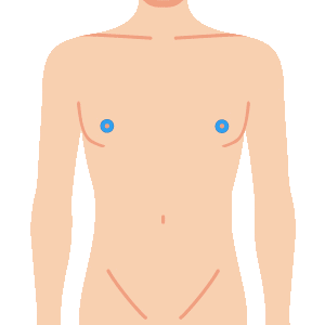 L body nyuurin - メンズ脱毛のメニュー