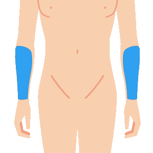 L body udeshita - メンズ脱毛のメニュー