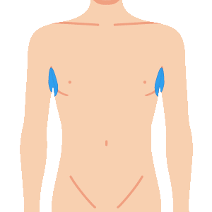 L body waki - メンズ脱毛のメニュー
