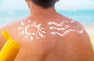 日焼け - メンズ脱毛後毛が抜けない？その原因と対策方法をチェック