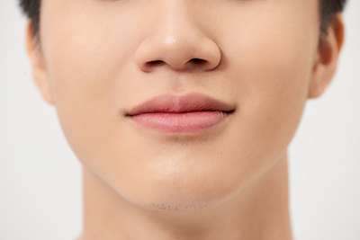 あご - 顎下にニキビができる&hellip;Uゾーンはヒゲ脱毛はするべき？