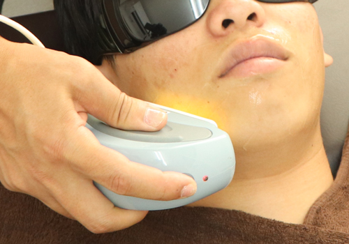 reason 4 - 【痛いヒゲ脱毛を軽減!!】痛くないヒゲ脱毛の施術方法や軽減方法などを徹底調査