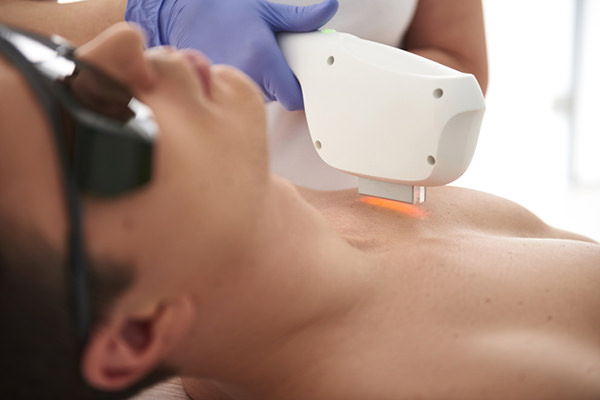 全身脱毛 - メンズの永久脱毛とは？後悔しないために把握すべき注意点