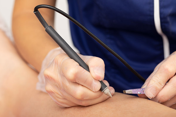 美容電気脱毛 - タトゥーが入っていても脱毛できる？タトゥー部分に照射するリスクや施術方法を解説