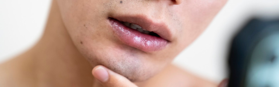 15 0 - ヒゲ脱毛の口コミで人気のサロンが解説！ヒゲ脱毛はすべき？ | メンズ脱毛NAX