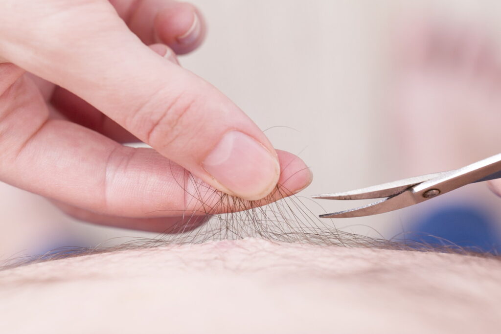 4 1 1024x683 - 【メンズ】脱毛サロン当日までの準備4人気施術前におすすめ処理 | メンズ脱毛NAX