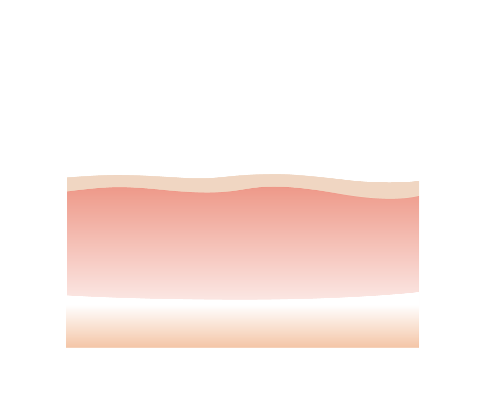 ダーマペン改善 - SELF IMPROVE料金【加古川店】
